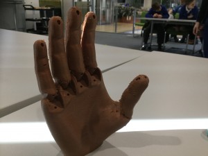 An amazing prosthetic hand.